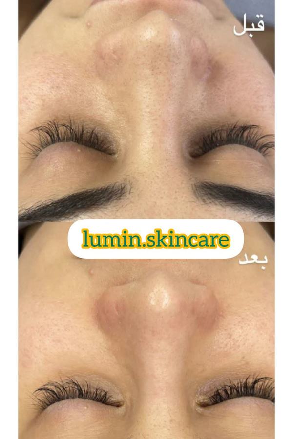 لومین 1